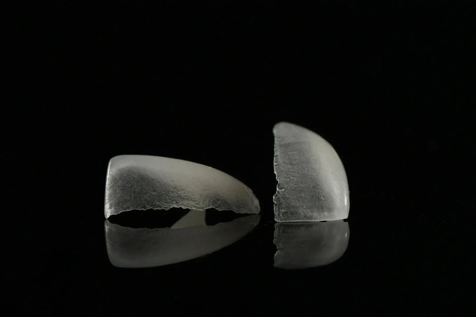 dental veneers
