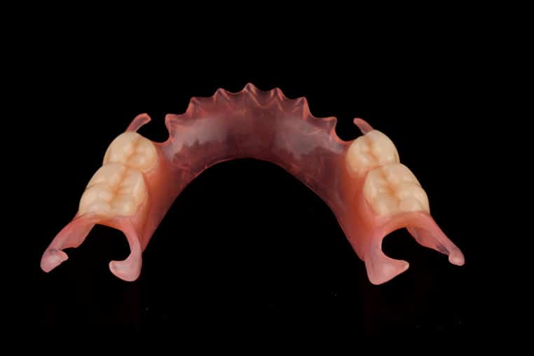 Flexible Partial Dentures