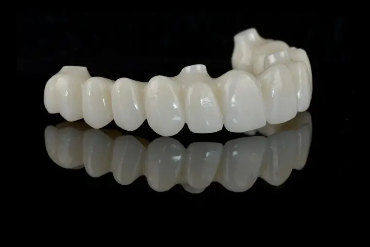 Layered Zirconia Crowns