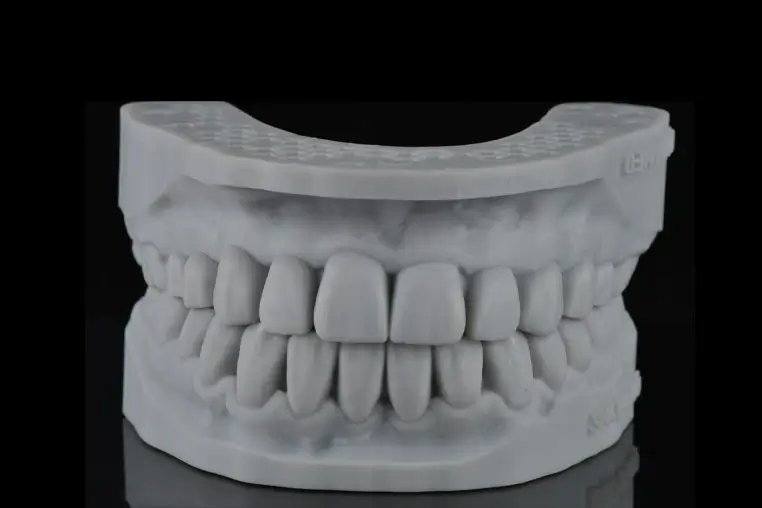 Finished dental cast