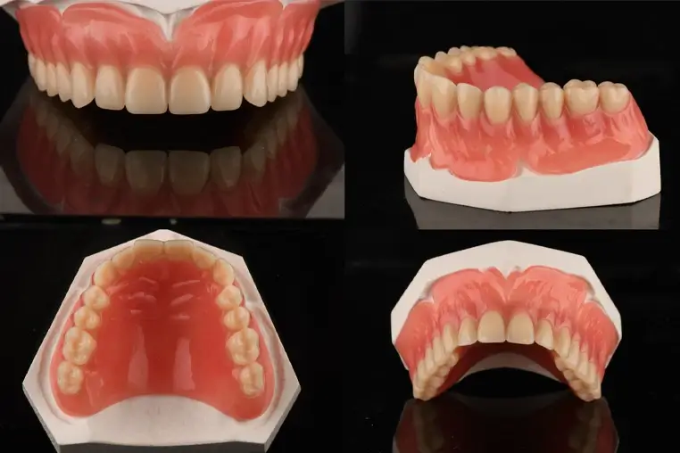 Removable Dentures