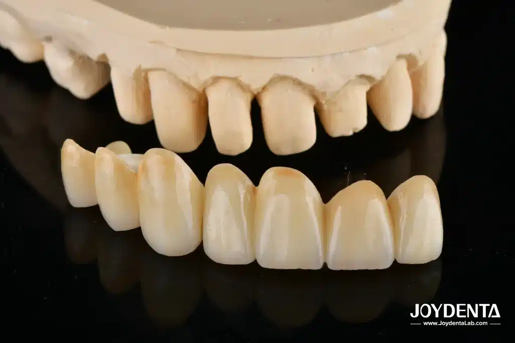 Zirconia Crowns
